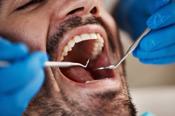 Best Same-Day Emergency Dental Services in Rockwell, NC