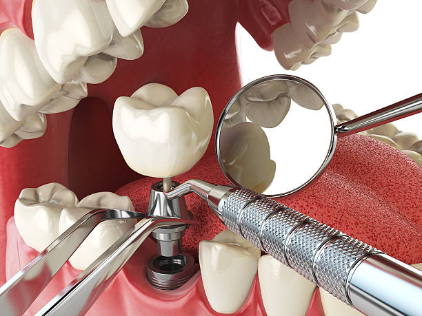Best Emergency Gum Treatment in Rockwell, NC